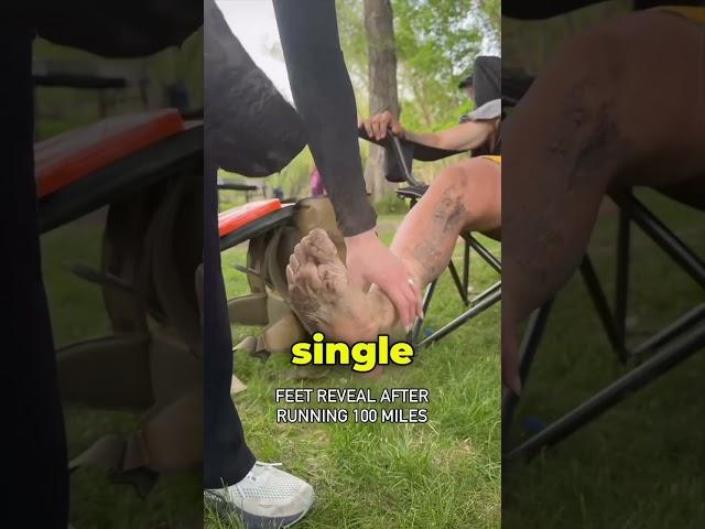 Feet After a 100 Mile Marathon (@BrockCovington)