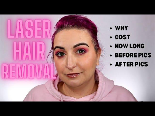 LASER HAIR REMOVAL: Why, Cost, Before + After... | Kirby Rose