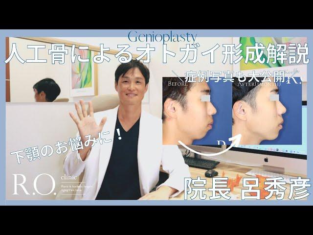 【オトガイ形成】〜下顎でお悩みの方必見〜 人工骨を使用したオトガイ形成のキホンから、症例写真解説まで！| R.O.clinic