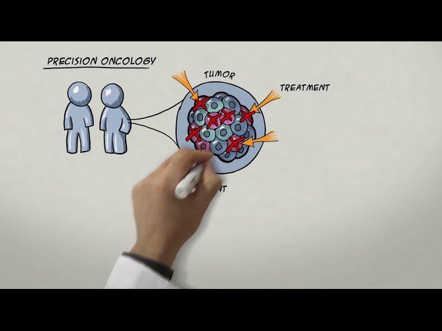 Chasing Metastatic Cancer Cells