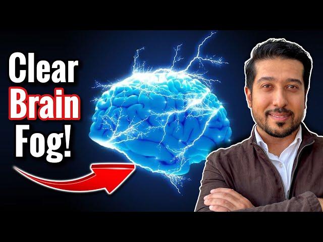 Clear Brain Fog Instantly | How I Got Rid of My Brain Fog FAST