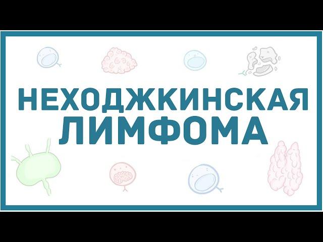 Неходжкинская лимфома - виды, причины, патогенез