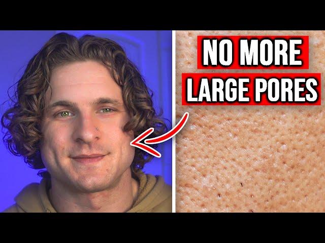 Best Ways to Get Rid Large Pores QUICKLY!