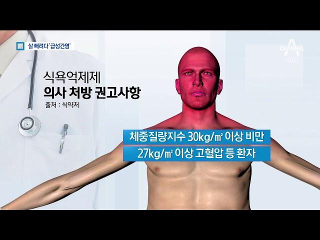 다이어트약 먹었더니 급성간염…부작용 심각