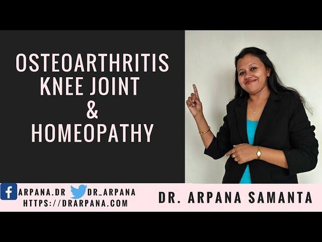 आर्थराइटिस या संधिवात, घुटनों का दर्द, होमियोपैथी दवाई  || OSTEOARTHRITIS Knee Joint & Homeopathy