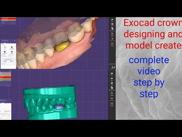 Exocad 3.0 Galway - How to Make Models/#Making Models in Exocad/#Exocad Model creator/#exocad design