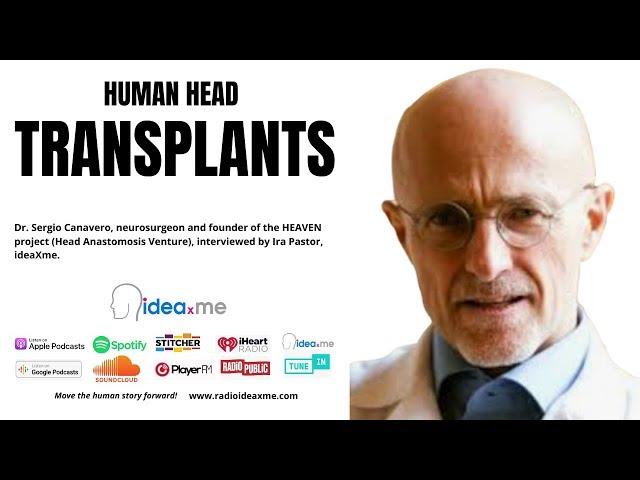 Human Head Transplants: Science Fiction Becomes Science Fact?