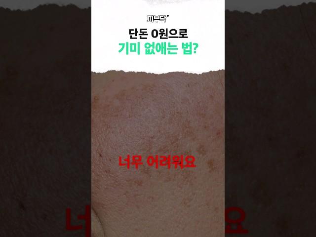 기미 헛돈 쓰지말고 제발 이렇게 따라해 보세요 #기미치료 #기미잡티 #기미레이저