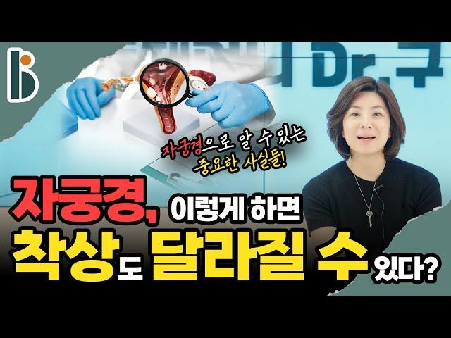 [둘째언니 Dr.구] 자궁경, 이렇게 하면 착상도 달라질 수 있다?