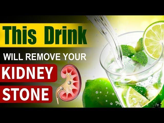 Karma Ayurveda emphasizes Lemon water for Kidney Stones | Karma Ayurveda Hospital