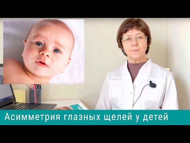 Узкая глазная щель у детей, асимметрия глазных щелей - симптом родовой травмы