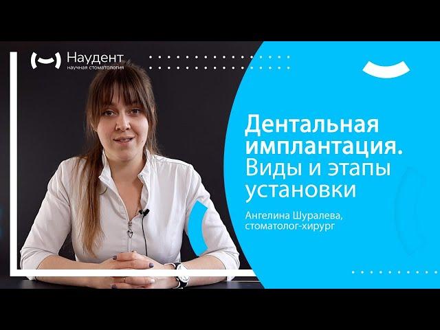 Дентальная имплантация. Виды и этапы установки
