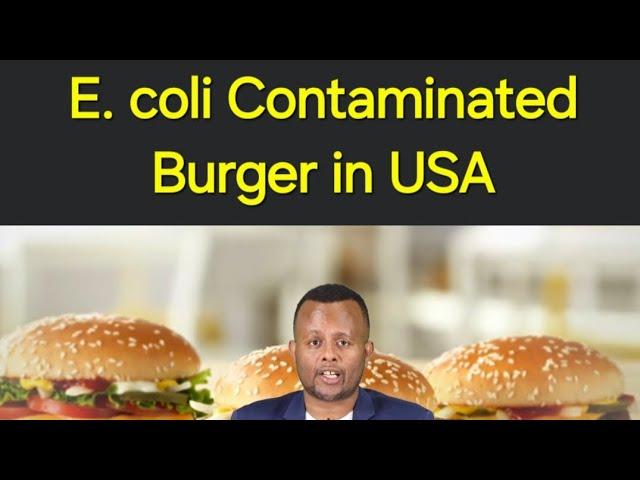 በE. coli ባክቴሪያ የተበከለ በርገር - CDC Report | በአሜሪካ ላላችሁ ከወረርሽኙ ጥንቃቄ አድርጉ | #foodcontamination