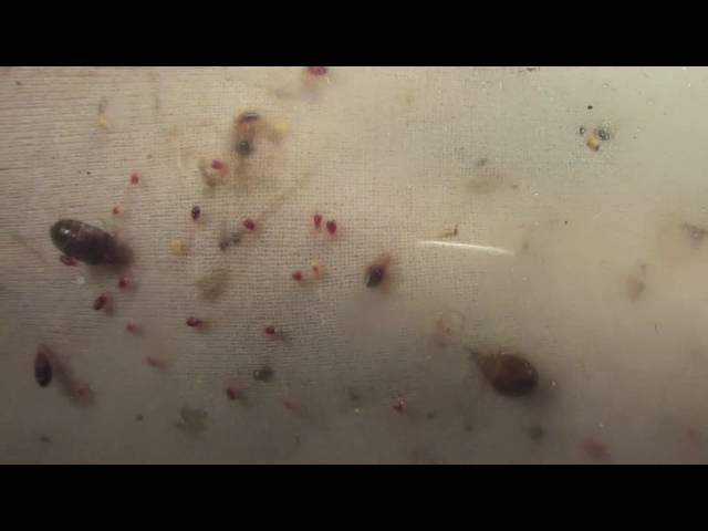 1000's of Bed Bugs Swarm hand!!!