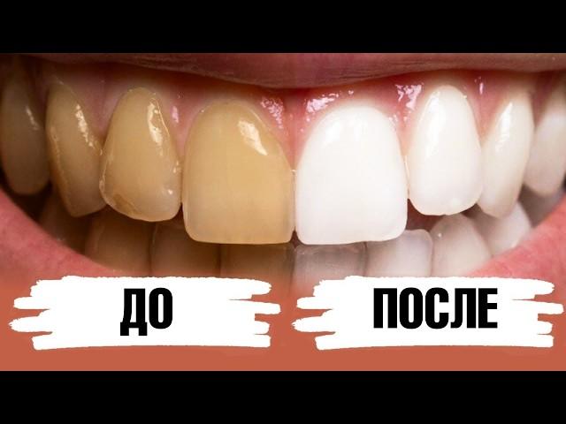 Как отбелить зубы дома? 2 ингредиента и зубная паста готова!