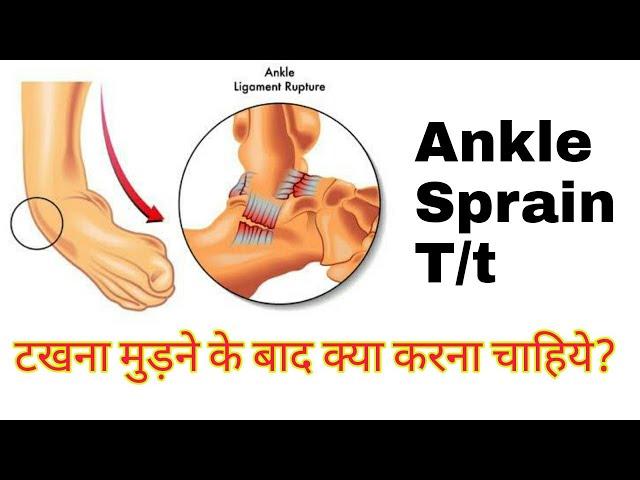 Ankle sprain exercises in hindi | Per ki moch ki exercise | Sprained ankle treatment at home