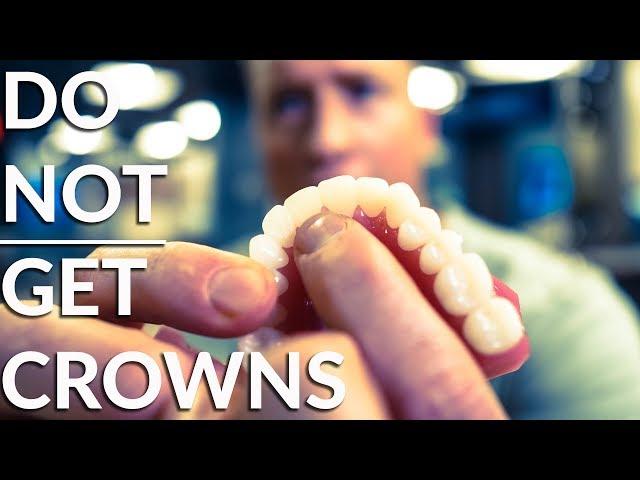 Do NOT crown your teeth! - Must watch before dental work!