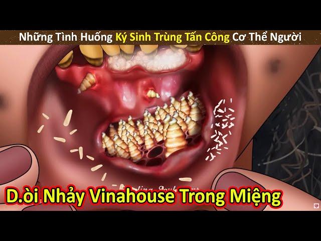 Nhím Cute Review Những Trường Hợp Con Người Bị Ký Sinh Trùng Xâm Nhập P8 || Review Giải Trí Đời Sống