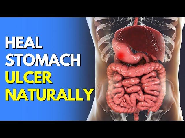 How to Heal a Stomach Ulcer Naturally at Home