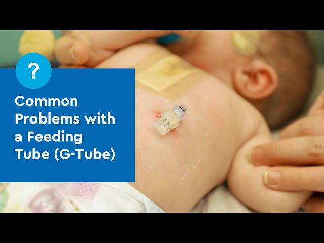 Common Problems with a Feeding Tube (G-Tube)