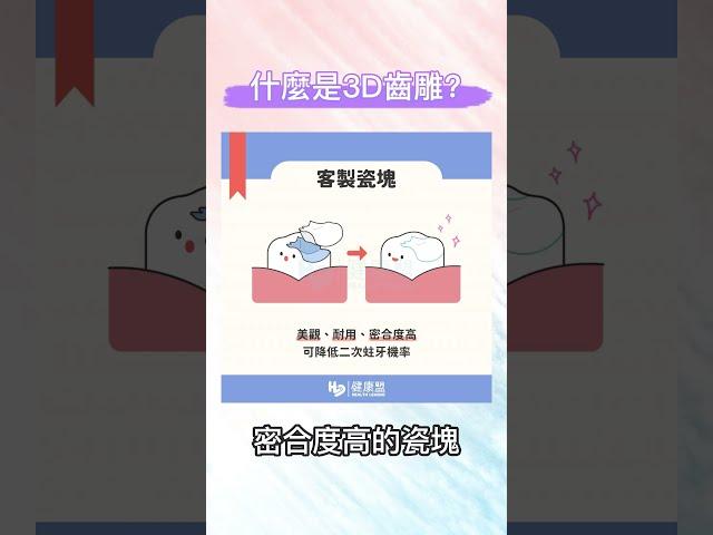 什麼是3D齒雕？ #健康盟 #3D齒雕 #3D齒雕還會蛀牙嗎 #3D齒雕要做多久 #一定要做3D齒雕嗎