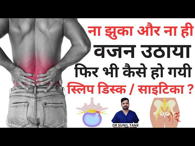 ना झुका और ना ही वजन उठाया, फिर भी कैसे हो गयी स्लिप डिस्क / साइटिका - Cause of Sciatica backpain