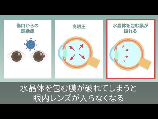 【サービス紹介動画】林眼科様【株式会社Lumii動画制作実績】