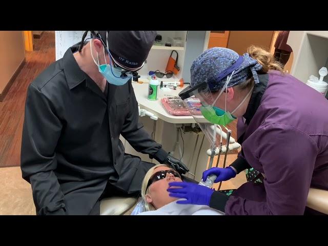 IV sedation treatment with restorative dentistry at Advanced Care Dentistry 1800Smiling.com