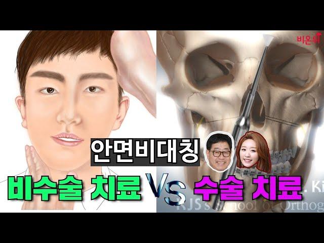 [라이브] ‘안면 비대칭의 비수술 치료 VS 수술 치료’ (건국대학교 치과양악수술센터 김재승 교수 & 차종은 PD)