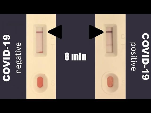 COVID-19 IgM/IgG Rapid Test