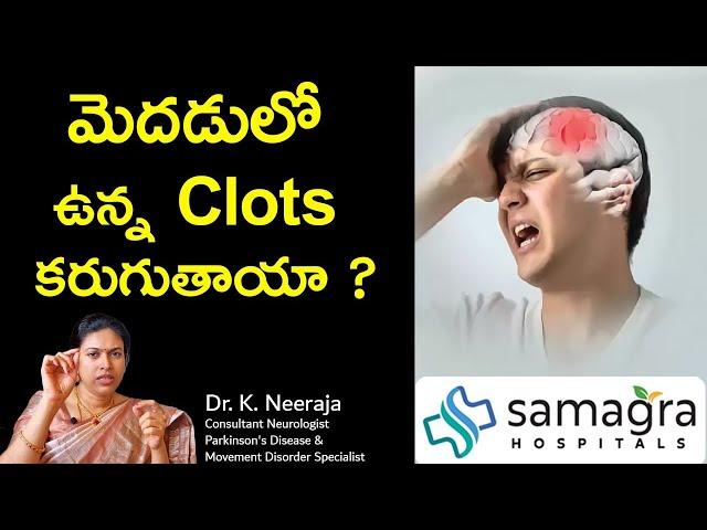 Do The Clots in The Brain Dissolve? #BrainClots #DrKNeeraja #Neurologist #Guntur #SamagraHospitals