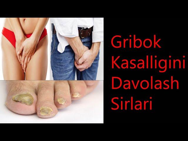 Gribok Kasalligini Davolash Sirlari | Гирибок Касаллигини Даволаш Сирлари