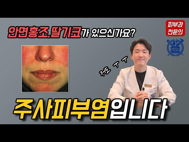 주사피부염 (Rosacea)의 유형과 치료, 일상생활 속 관리법과 화장품 선택까지 - 피부과전문의 닥터피부광