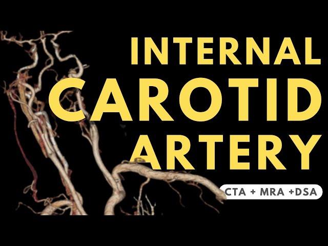 Internal Carotid Artery Segments and Branches | Radiology anatomy part 1 prep | Angiography