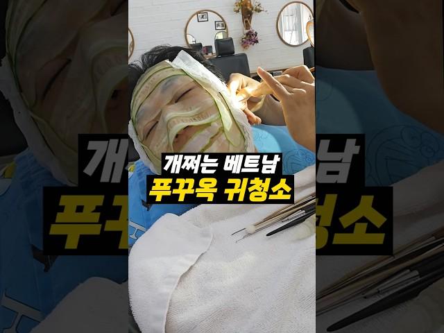 베트남 귀청소 스페샬 서비스