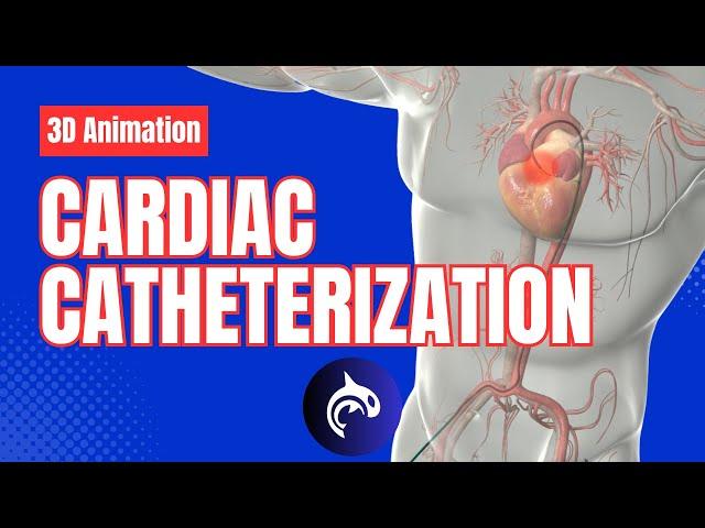 Cardiac Catheterization - 3D Animation