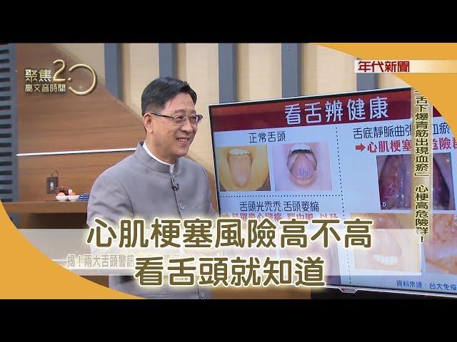 快照鏡子！舌頭看出心肌梗塞、胃癌警訊【聚焦2.0】342集