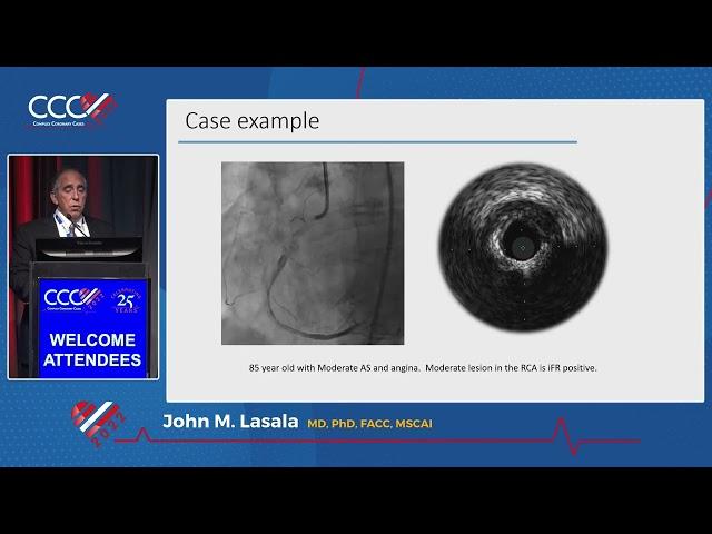 Calcification  IVL: Final Treatment - John M  Lasala, MD