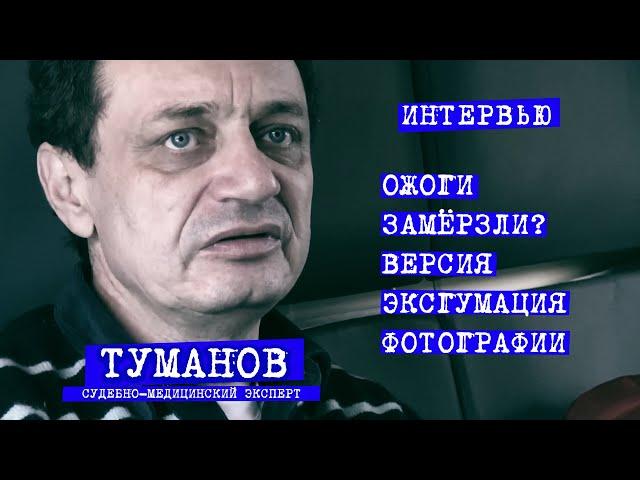 Перевал Дятлова. Судмедэксперт Туманов. версии, ожоги, фотографии