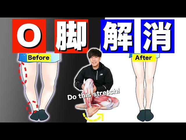 Stretch for 'Bowlegs That Hinder You From Losing Leg Fats' '#2 Weeks Bowleg Improvement Challenge'