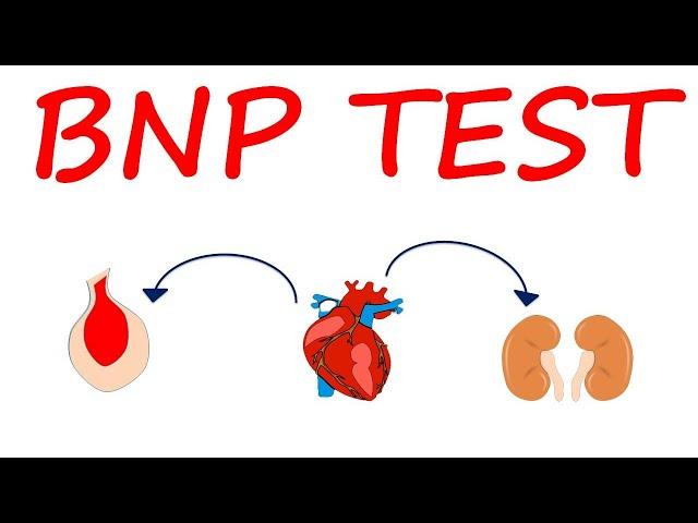 Brain Natriuretic Peptide (BNP) Test for heart failure