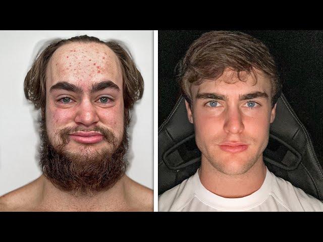 I'm an ugly guy that tried 'Looksmaxxing' for 7 Days