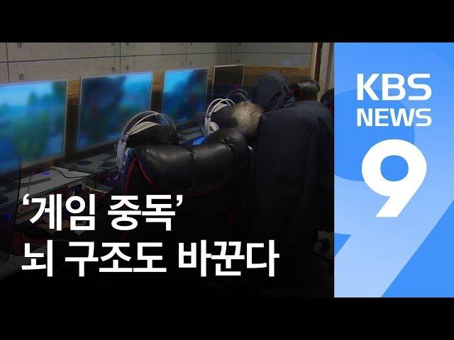 [앵커의 눈] ‘게임 중독’ 뇌 구조도 바꾼다…조기 치료 중요 / KBS뉴스(News)