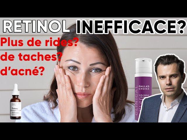 RETINOL: INEFFICACE ET DANGEREUX? 7 conseils