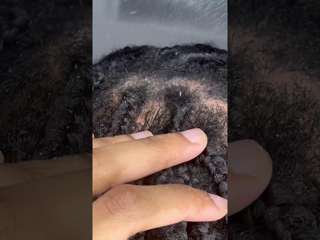 ASMR Braids Scratching!!️