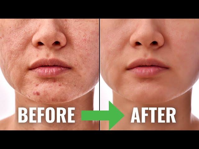 THIS is WHY You Need To Use Niacinamide