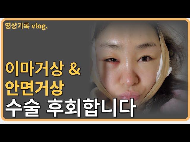 이마거상 안면거상수술 동시에 받았더니 ㅣ 수술직후부터 + 8일차까지의  리얼영상vlog ㅣ 광고 X