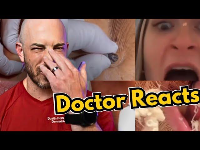 Dermatologist Reacts to Viral TikToks | Cyst Popping, Pimple Popping