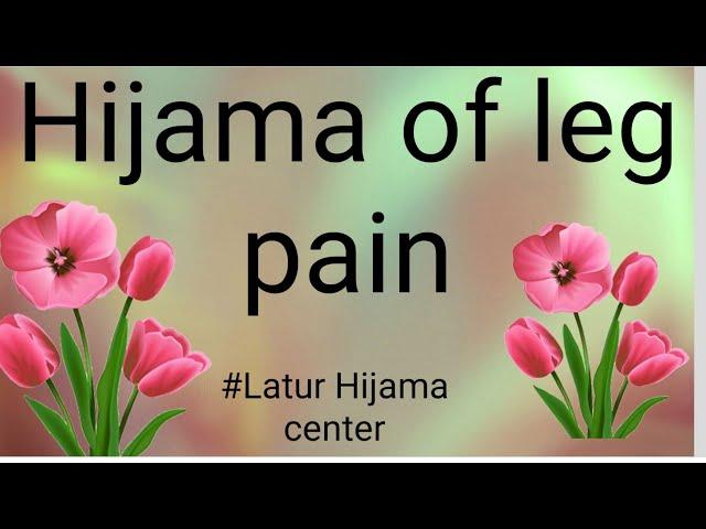 Hijama of leg pain | Latur Hijama center