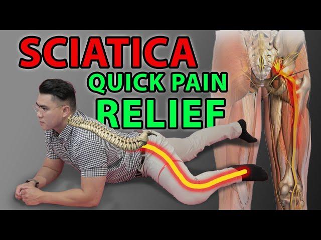 One Minute Sciatica Exercise to Cure Sciatica & Quick Pain Relief | Leg Pain Sciatica Disc Bulges